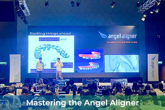 Mastering the Angel Aligner